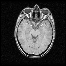MRI from my own brain
Axial (Inferior) view
