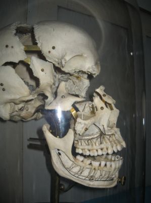 Vienna
Dental museum
