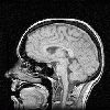Sagittal.jpg